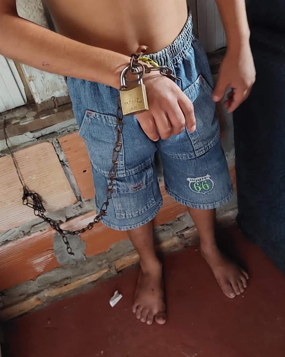 Criança torturada pelo pai em Manaus é resgatada pela Polícia Civil