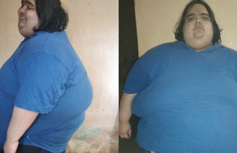 Jovem passa dos 300 kg em SP e não consegue mais se pesar: ‘tenho muita fome’