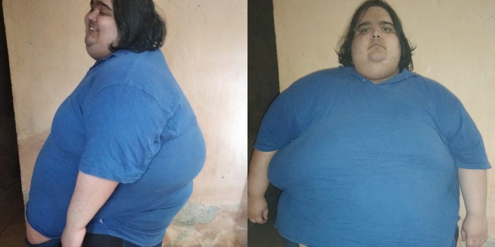Jovem passa dos 300 kg em SP e não consegue mais se pesar: ‘tenho muita fome’