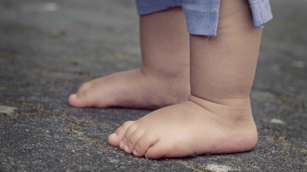 Criança de 3 anos tem órgão genital quase decepado em Colíder