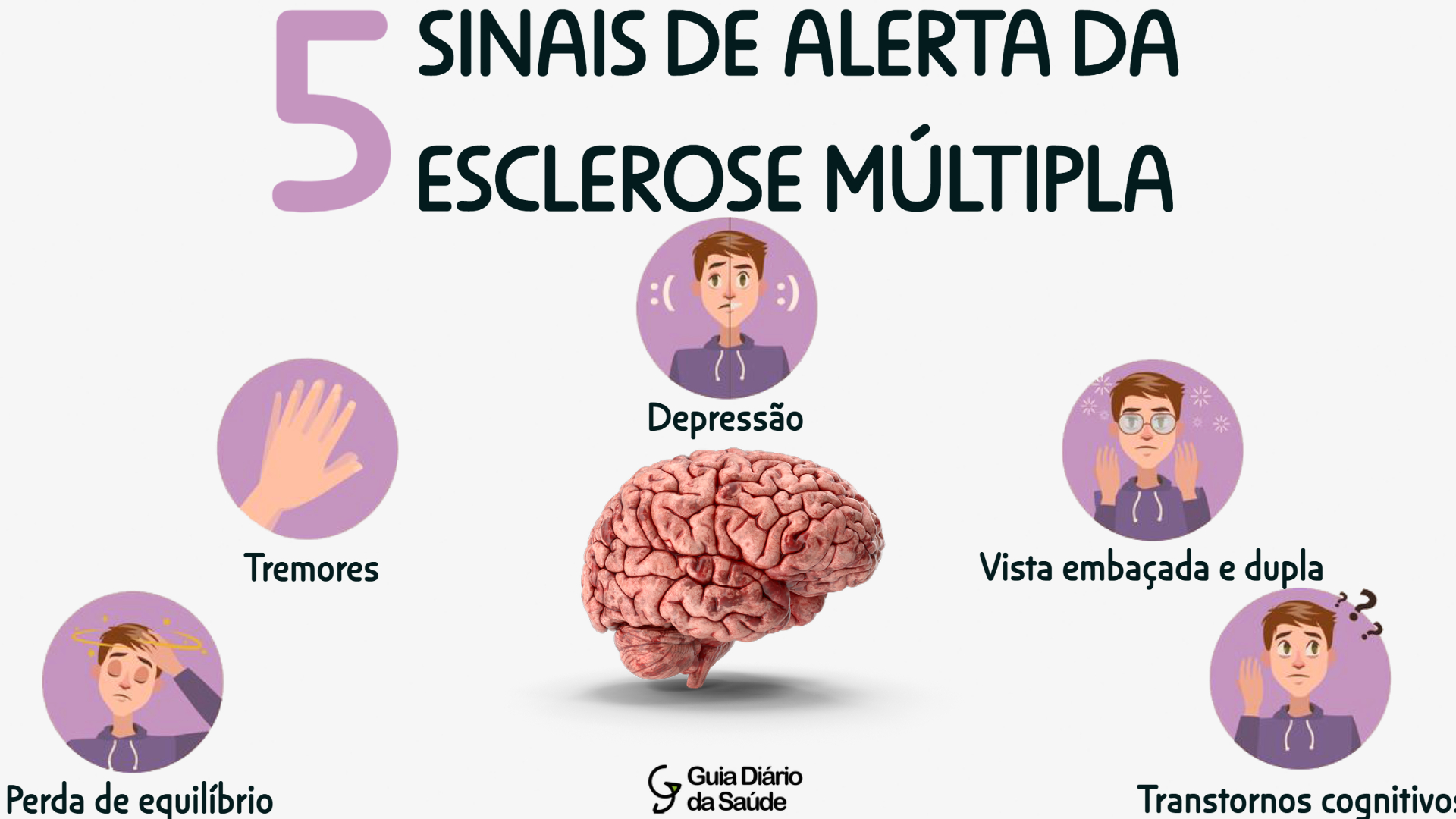 6 sintomas iniciais e surpreendentes da Esclerose Múltipla