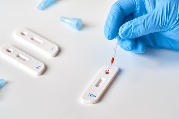 Entenda as diferenças entre RT-PCR, antígeno e autoteste