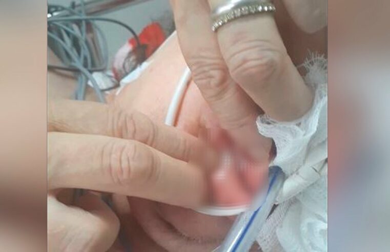 Paciente é encontrada com larvas na boca em hospital de Santa Maria: ‘Não acreditei’, diz irmã