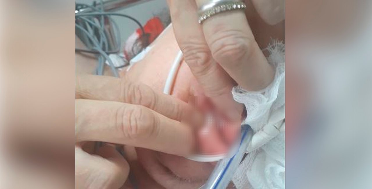 Paciente é encontrada com larvas na boca em hospital de Santa Maria: ‘Não acreditei’, diz irmã