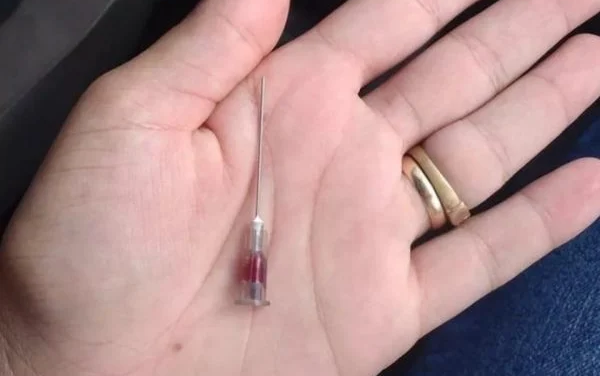 SP: pronto-socorro esquece agulha em criança após injeção