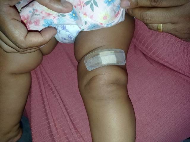 Bebê de 9 meses sofre com ferida aberta na perna e mãe denuncia erro de vacinação em posto de saúde