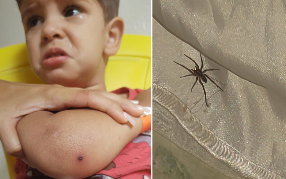 Menino é internado após ser picado por aranha em Aparecida de Goiânia