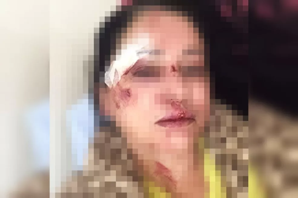 Moradora de Palmital diz que foi agredida por nove vizinhos por acharem que ela havia denunciado som alto à polícia