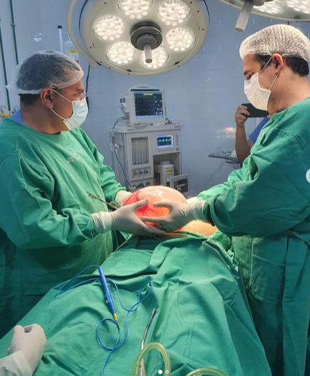 Médicos retiram cisto de 5 kg do ovário de idosa durante cirurgia de emergência no PI