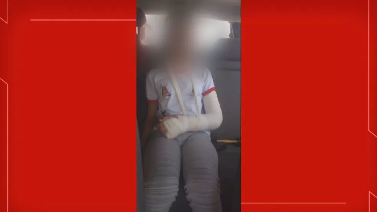 Mulher quebra braço de menina de 11 anos após achar que criança estava rindo dela