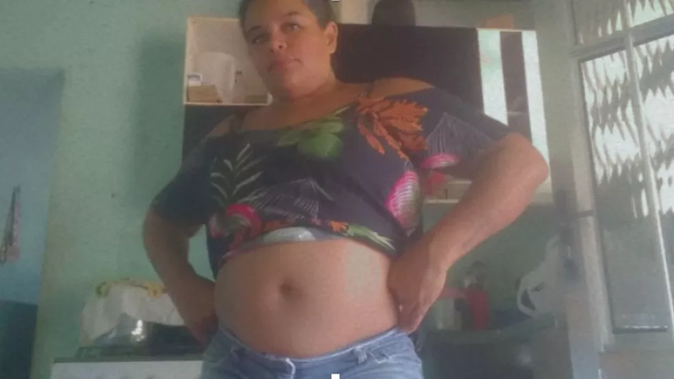Mulher vai ao médico com dores nas costas e descobre estar grávida de quase oito meses: ‘assustador’