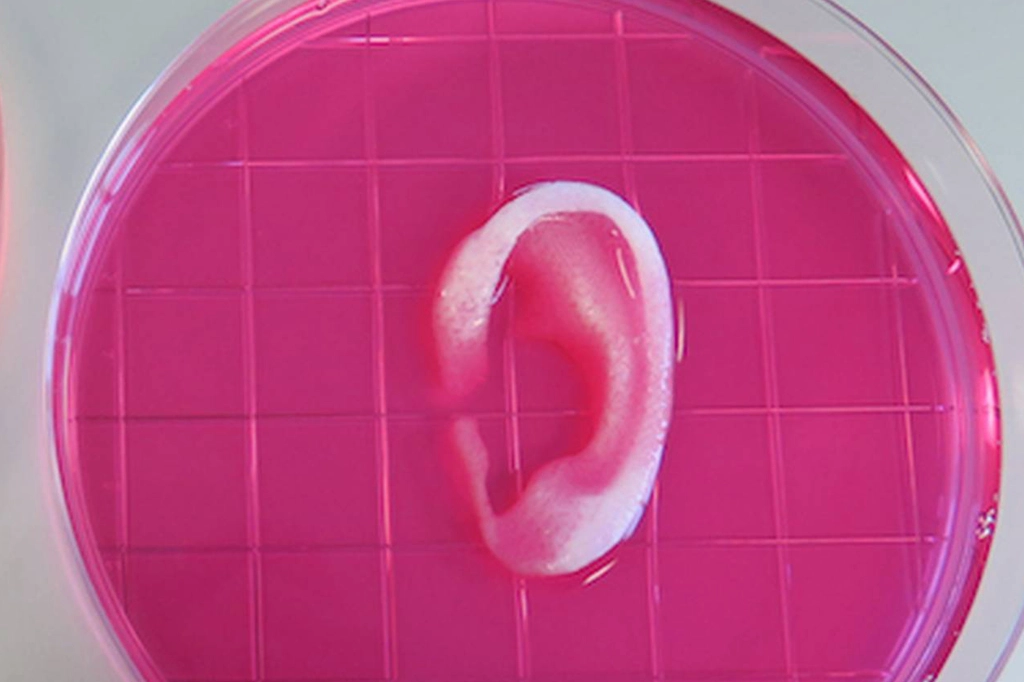 Cientistas fazem, pela 1ª vez, transplante de orelha impressa em 3D