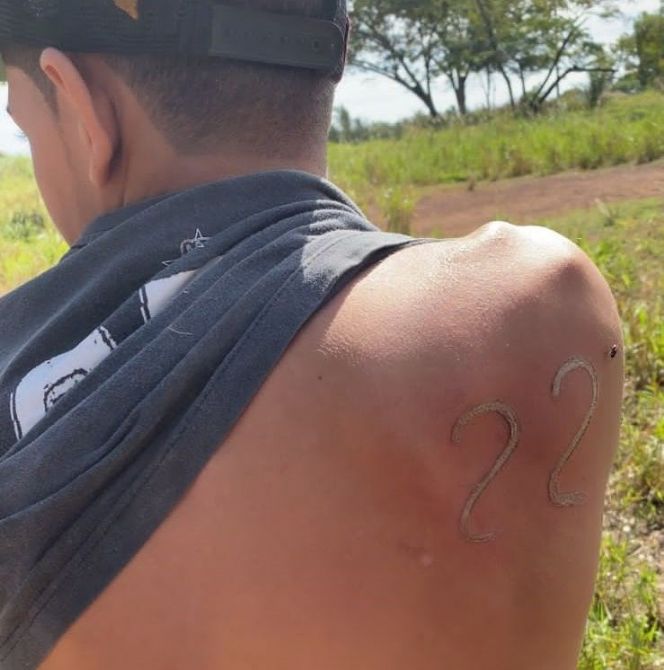 Jovem usa ferro de marcar gado para tatuar o 22 de Bolsonaro em MT