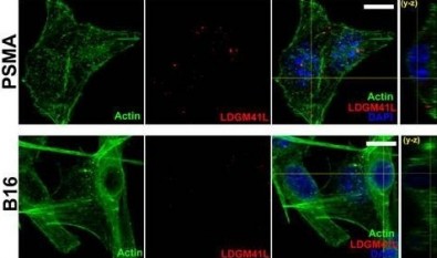 Estudo avança no desenvolvimento de biofármaco para tratamento de câncer de próstata