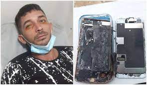 Iphone explode e pega fogo em rosto de jovem no Ceará