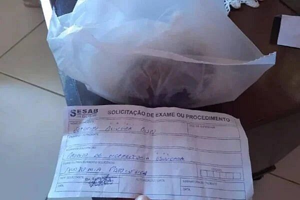 Bahia: rapaz baleado perde rim e família recebe órgão em saco plástico