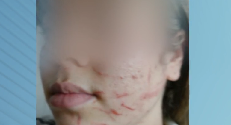 Adolescente se envolve em briga após sofrer bullying e é suspensa por 30 dias em escola de SP