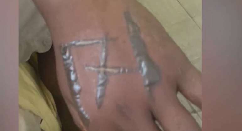 Funcionários acusam patrões de tatuarem ‘171’ no corpo deles usando ferro quente