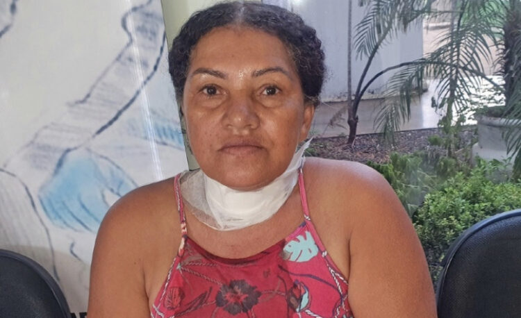 Mulher tem pescoço cortado por linha de pipa com cerol em MT