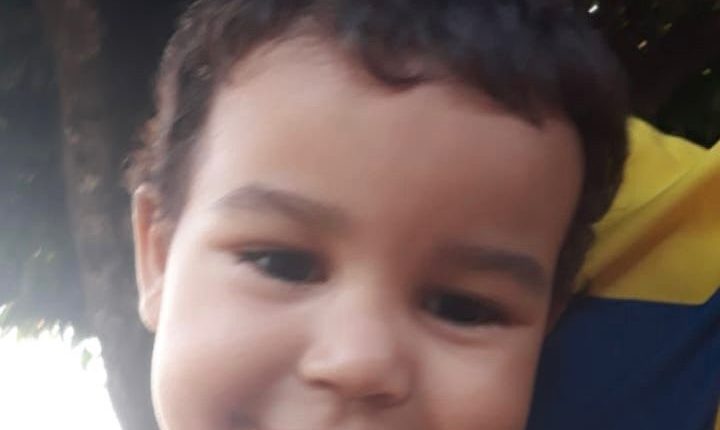 Criança vítima de queimadura em Sinop não resiste e morre