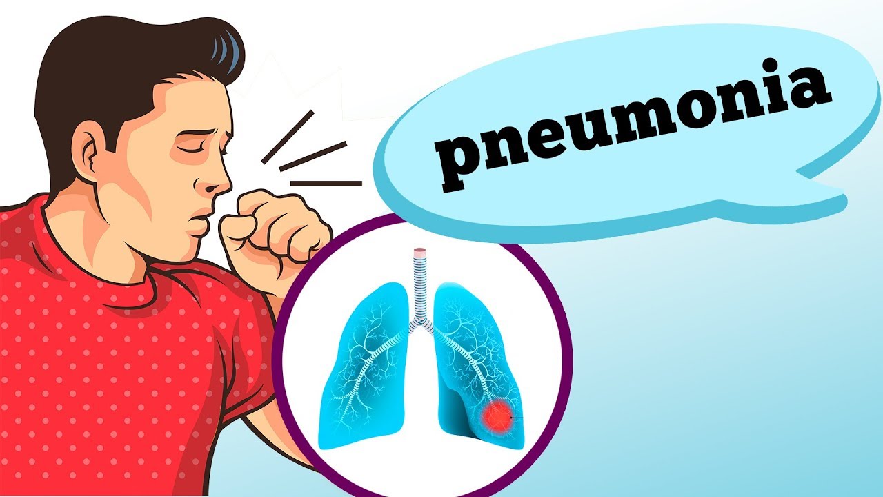 Argentina chega a seis mortos em surto de pneumonia causada pela bactéria legionella