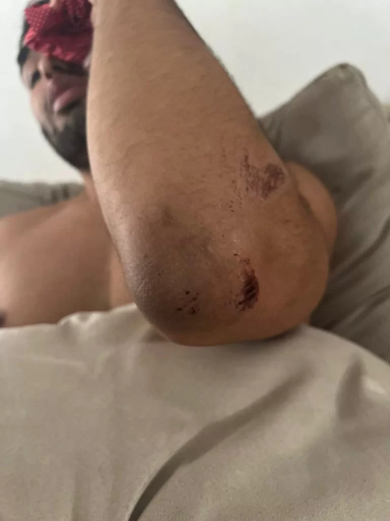 Bêbada, personal destrói bar, xinga PM e é detida com filho de 17 anos