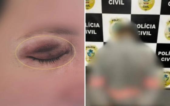 Homem espera amiga dormir, leva para motel e estupra em GO
