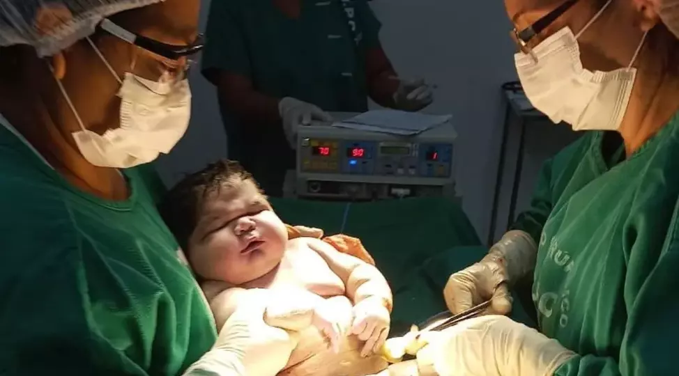 Bebê nasce com mais de 7 kg e bate recorde no Amazonas