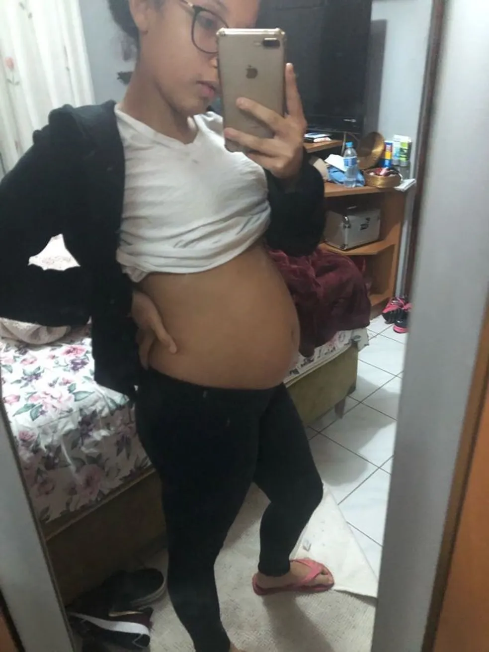 ‘Meu cisto de ovário era maior do que um bebê’