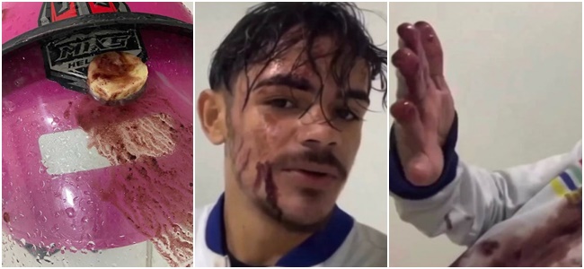 Motoboy denuncia agressão por atraso em entrega de açaí, na Paraíba