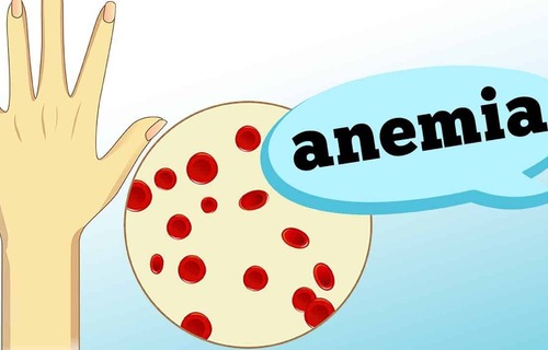 ANEMIA: sintomas, causas e gravidade